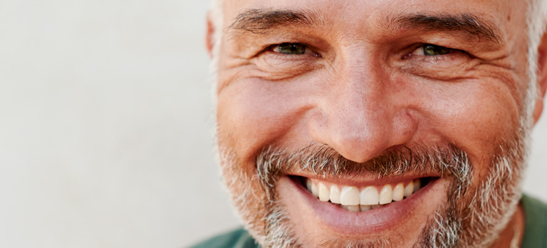 Beneﬁts of Dental Implants