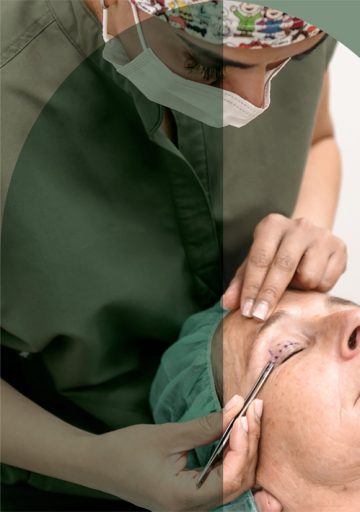 blepharoplasty-home-m