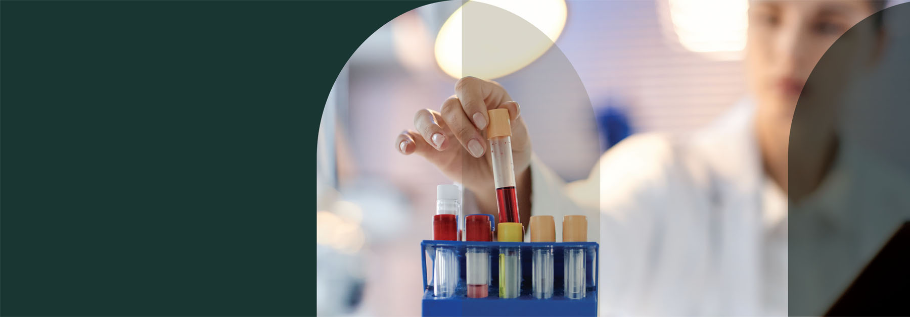 blood-test-banner-img