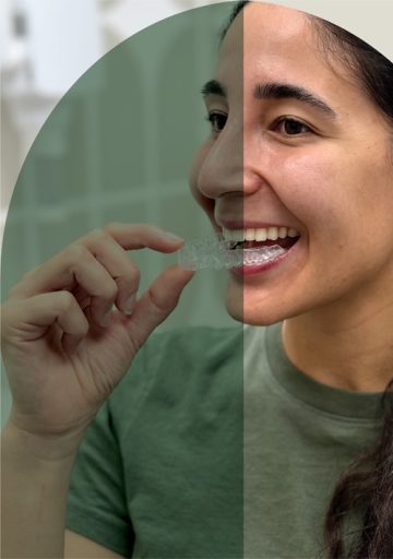 clear-aligner-home-m