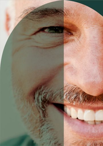 dental-implants-home-m