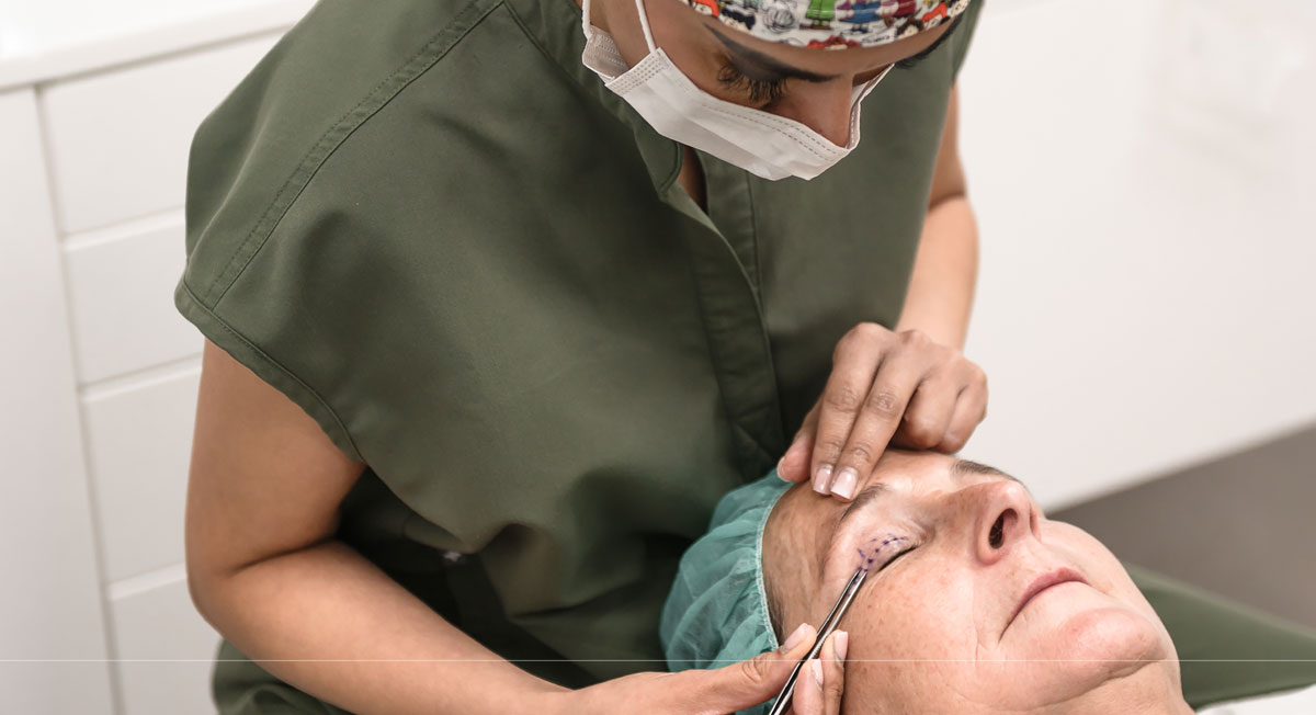 blepharoplasty-img